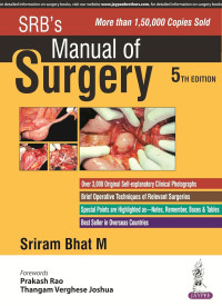 Image of SRB\'S Manual of Surgery